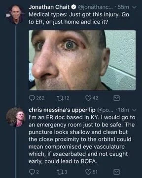Jon Chait: Medical types, just got this injury, go to ER or just home and ice it?

Chris: I am an ER doc based in Kentucky. I would go to an emergency room just to be safe. The puncture looks shallow and clean but the close proximity to the orbit orchid mean compromised eye vasculature which, if exacerbated not quite early could lead to￼ BOFA
